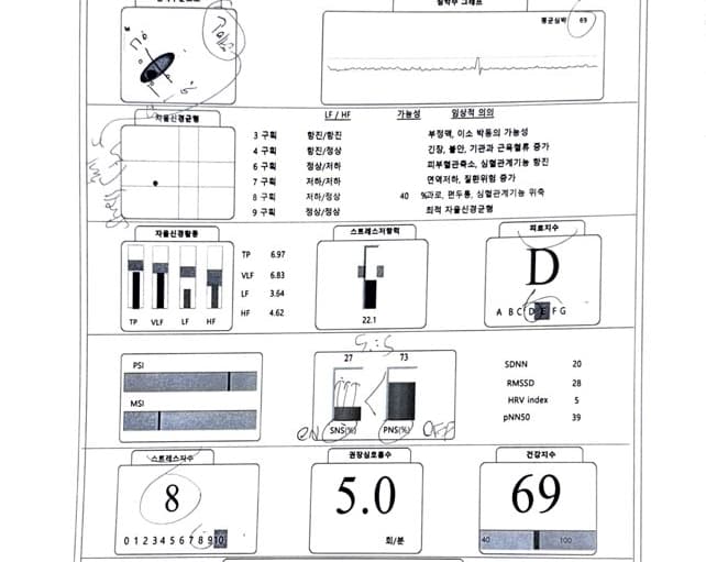 소화불량 3가지 원인(열, 한, 스트레스)
