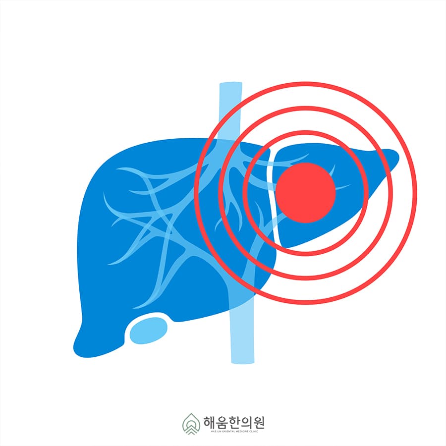 장상피화생, 치료 안 하면 위암으로 이어질 수 있습니다