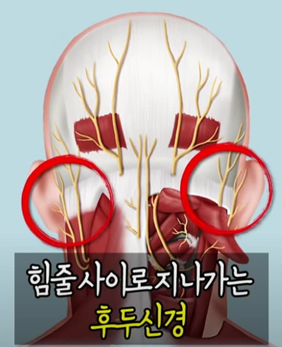 뒷머리 찌릿 반복된다면 꼭 확인해야 할 원인