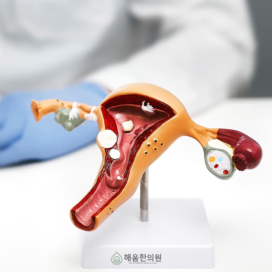 생리전 냉증가 정상일까? 헷갈릴 때 꼭 알아야 할 기준